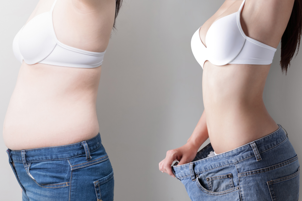 Liposuction cost in Hyderabad