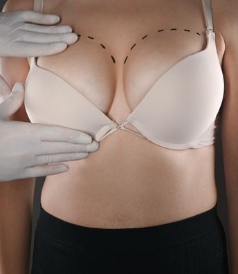 Cost of Breast Reduction Surgery in Hyderabad