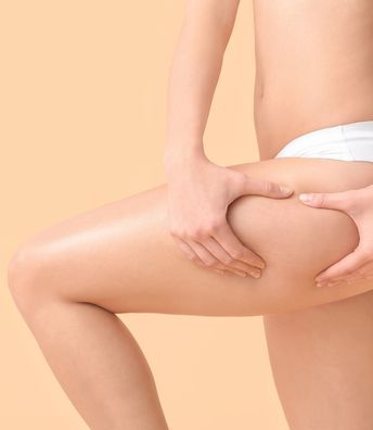 Outer+Thighs+Liposuction+in+Hyderabad