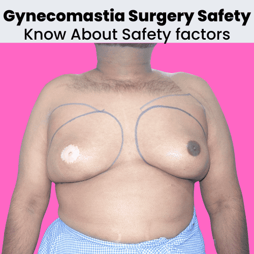 Is Gynecomastia surgery safe