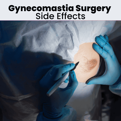 Gynecomastia surgery side effects